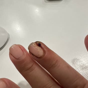 Gratis Beauty ArenaPark Tırnak Enfekte (mikrop) Olması