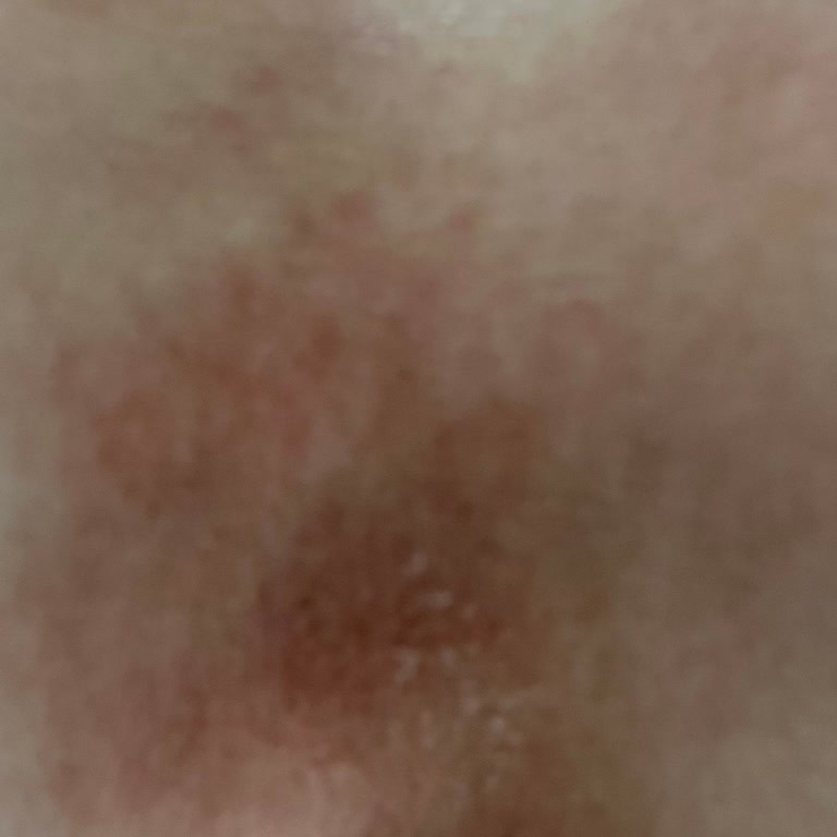 Essay (By Esra Ezmeci) Ürün İncelemesi Ve Cilt Tepkisi