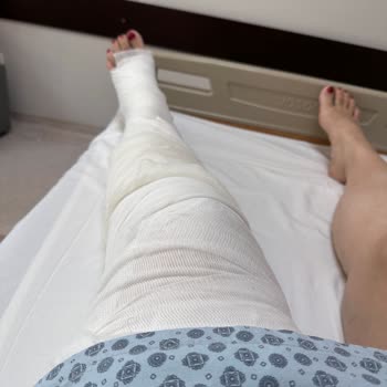 Ne Otel Ne ETS Tur Bize Sahip Çıktı! Canımdan Oluyordum!