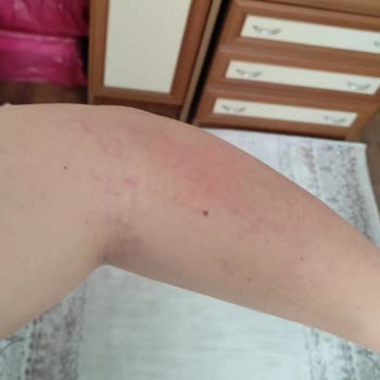 Veet Tüy Dökücü Krem Pişmanlıktır. Yazıklar Olsun