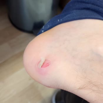 Beymen Ayakkabıda Kalite Sorunu Ve İade Talebinin Reddi.