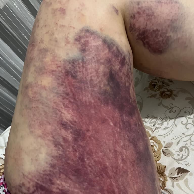 Vialife Estetik Yaşadığım Mağduriyet
