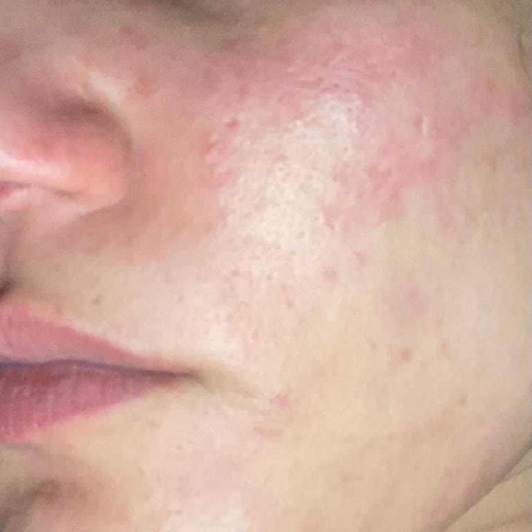Bioderma Güneş Kremi Şikayeti