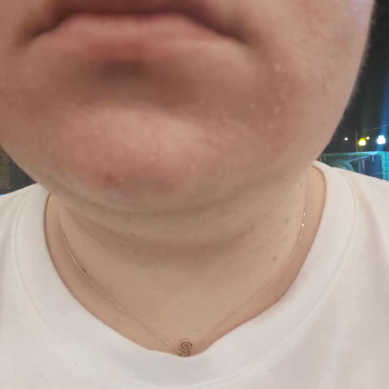 SHE Vec Sarı Tonik Yüzümü Yaktı