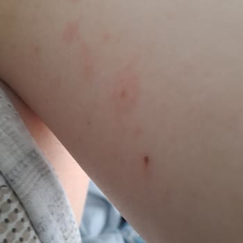 Mustela Çatlak Kremi Hamilelik