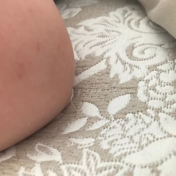 Mustela Güneş Kremi Alerji Sorunu