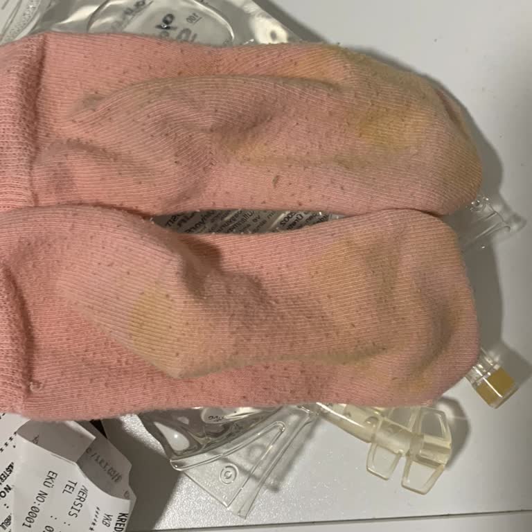 İgor Sandalet Boya Çıkardı