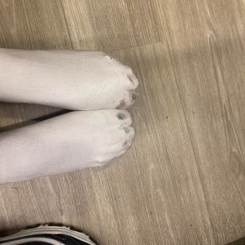 Skechers 5000 TL'lik Ayakkabı Renk Verdi, Mağaza İlgisiz!