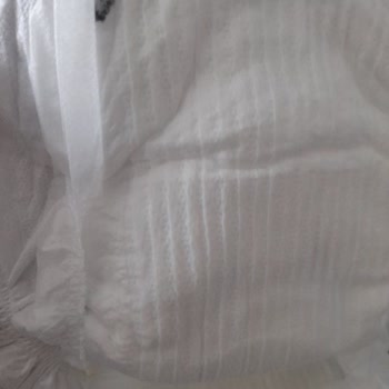 Molfix Bebek Bezinde Tanımlanamayan Cisim