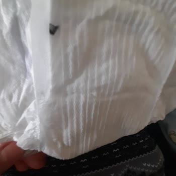 Molfix Bebek Bezinde Tanımlanamayan Cisim