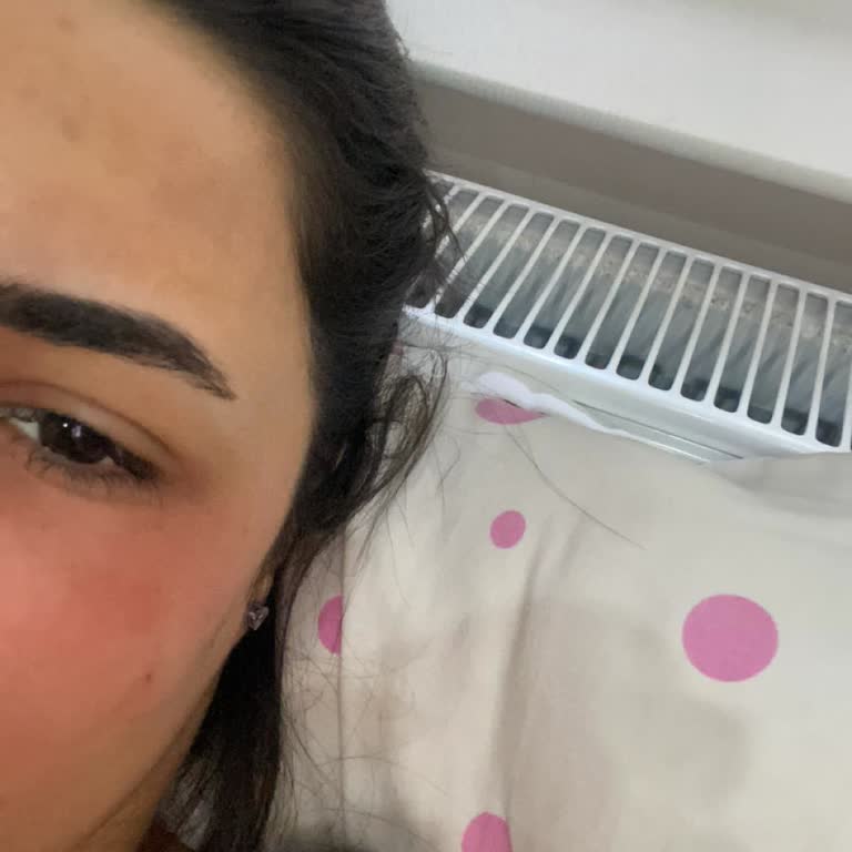 The Purest Solutions The Purest Serumu Yüzümü Yaktı! Yüzümdeki Yanık İzleri Geçecek Mi!