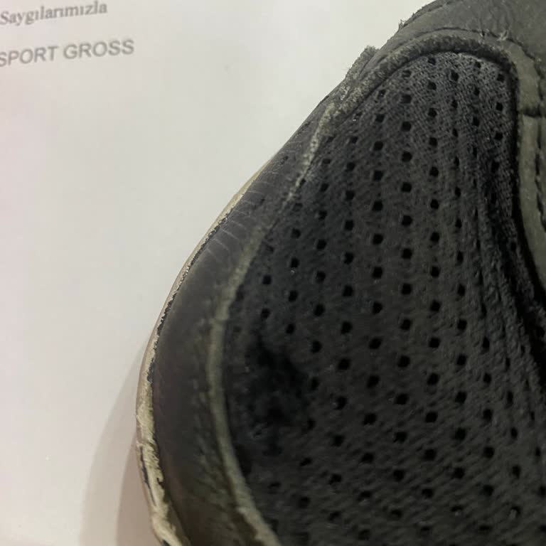 Sportgross Ve Skechers Ayakkabı Kalitesizliği: 2 Ayda Yırtılan Ayakkabılar
