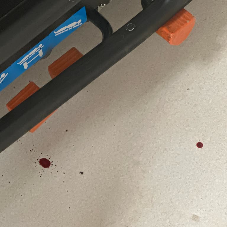 Antalya Şehir Hastanesi Sarı Alan Serum Bölümü Hijyen Sorunu