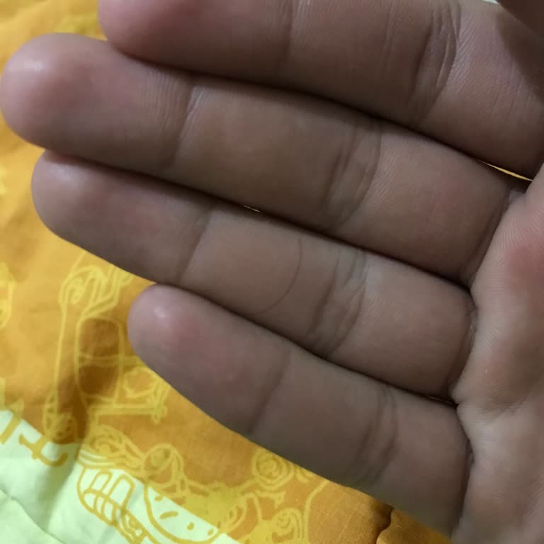 Bioxcin Daha Fazla Döküyor Saçları