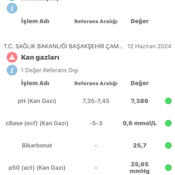 Zurna Dürüm Yediğim Dönerden Zehirlendim