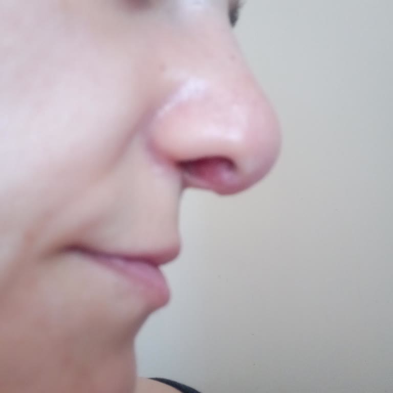 Seyithan Kırtay Başarısız Ameliyat Ve İlgisizlik