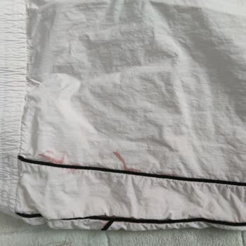 H&M Kusurlu Mal İadesini Kabul Etmiyor