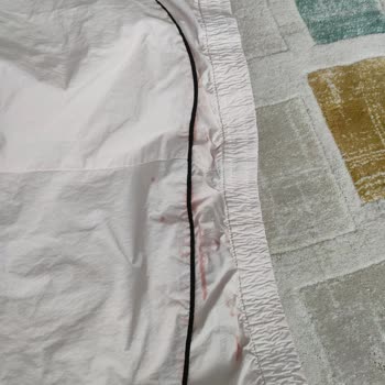 H&M Kusurlu Mal İadesini Kabul Etmiyor