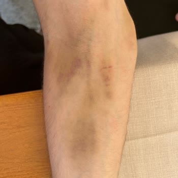 Medical Park Hastanesi Acil Serviste Yaşadığım Olumsuz Deneyim