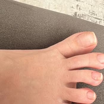 Dilan Toprak Beauty Hijyen Yoksunu Bir Yerdi