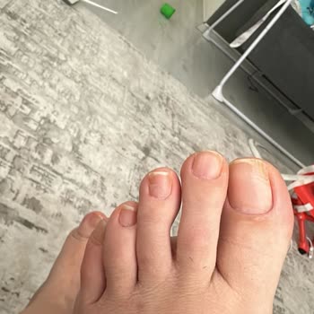 Dilan Toprak Beauty Hijyen Yoksunu Bir Yerdi