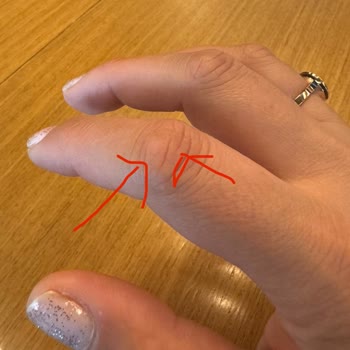 Dyson Elleri Nasır Yapıyor!