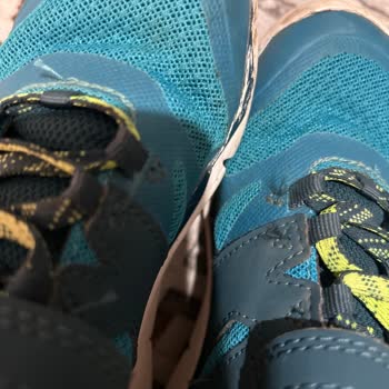 Decathlon 2 Ay Geçmeden Deforme Olan Ürünü Fiş Yok Diye Kabul Etmediler