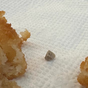 Popeyes Soğan Halkasından Taş Çıktı