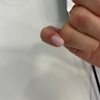 Olga Tırnak Center Manikür Mağduriyeti, Umursamazlık