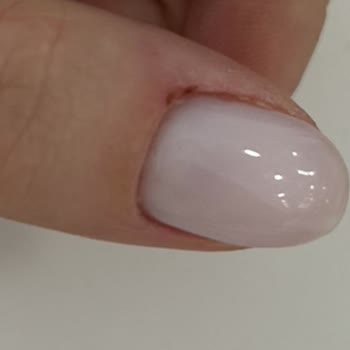 Olga Tırnak Center Manikür Mağduriyeti, Umursamazlık