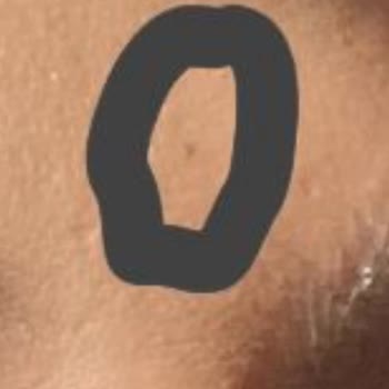 İdea Klinik Ben Aldırma İşlemi