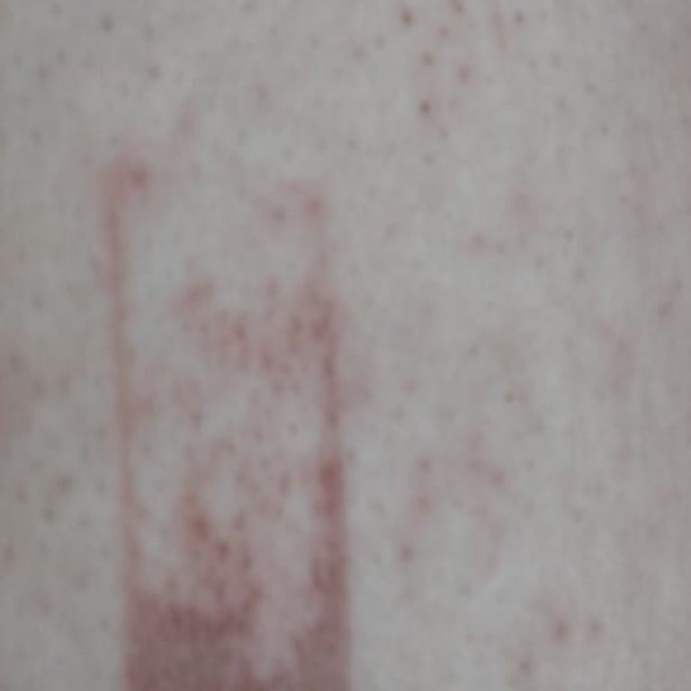 Lavinya Golden Malatya Şubesi Lazer Epilasyon Tam Bir Kabus