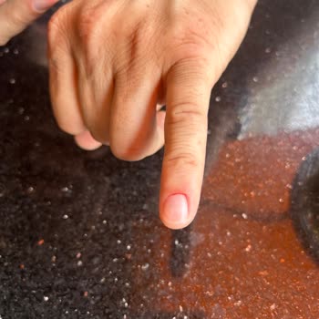 Birgül Çoban Güzellik Hayal Kırıklığı Ve Yüksek Ücretler