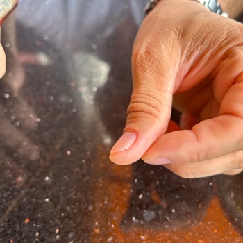 Birgül Çoban Güzellik Hayal Kırıklığı Ve Yüksek Ücretler