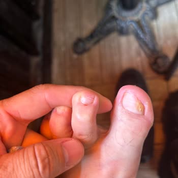 Birgül Çoban Güzellik Hayal Kırıklığı Ve Yüksek Ücretler