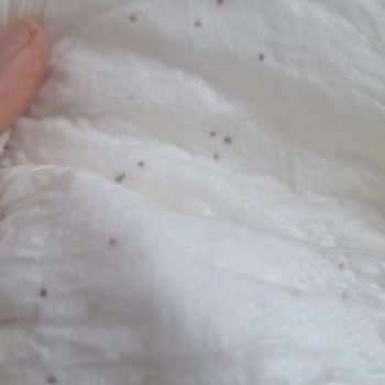 Sleepy Oğlumun Sırt Kısmına Kaşıntı Yaptı