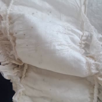 Sleepy Oğlumun Sırt Kısmına Kaşıntı Yaptı