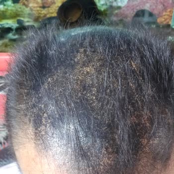 Batçı Hair Atelier Ürün Kullanımı Sonrası Yaşanan Hayal Kırıklığı