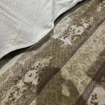 Sesu Sir Ağda Dökülmesi Ve Vücut Yanıkları