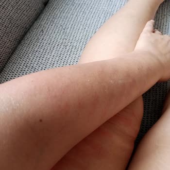 Derya Ataş Beauty Center Bakım Değil İşkence