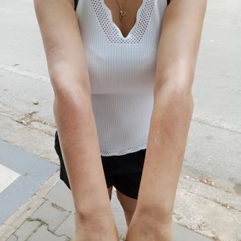 Derya Ataş Beauty Center Bakım Değil İşkence