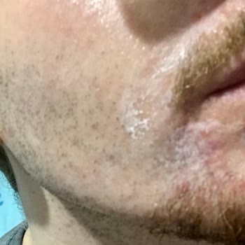 La Roche Posay Cicaplast Baume B5 Ürünü İle İlgili Şikayetim