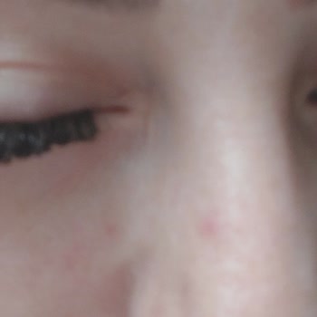 Kübra Aydın Beauty Center Güzellik Merkezi Üç Kuruş Para Kazanacağız Diye İnsanlara Zarar Vermeyin