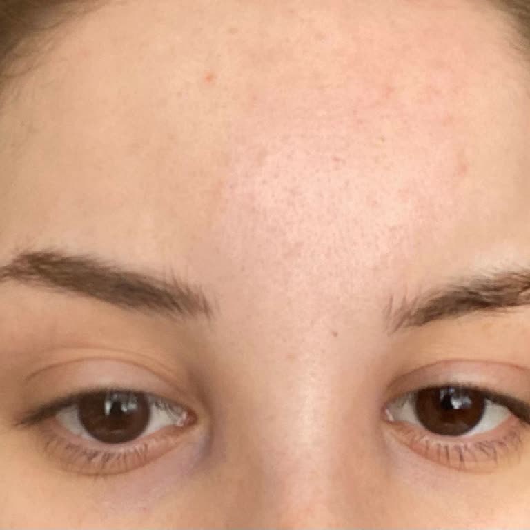 Pamukkale Otobüs Firması Hijyen Eksikliği