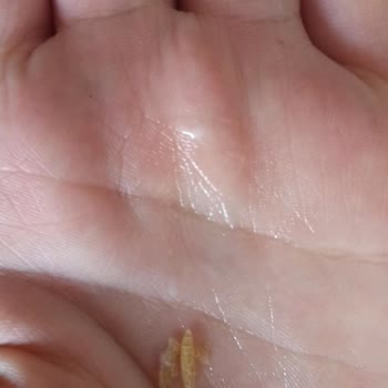 Algida Dondurmada Yabancı Cisim Bulundu