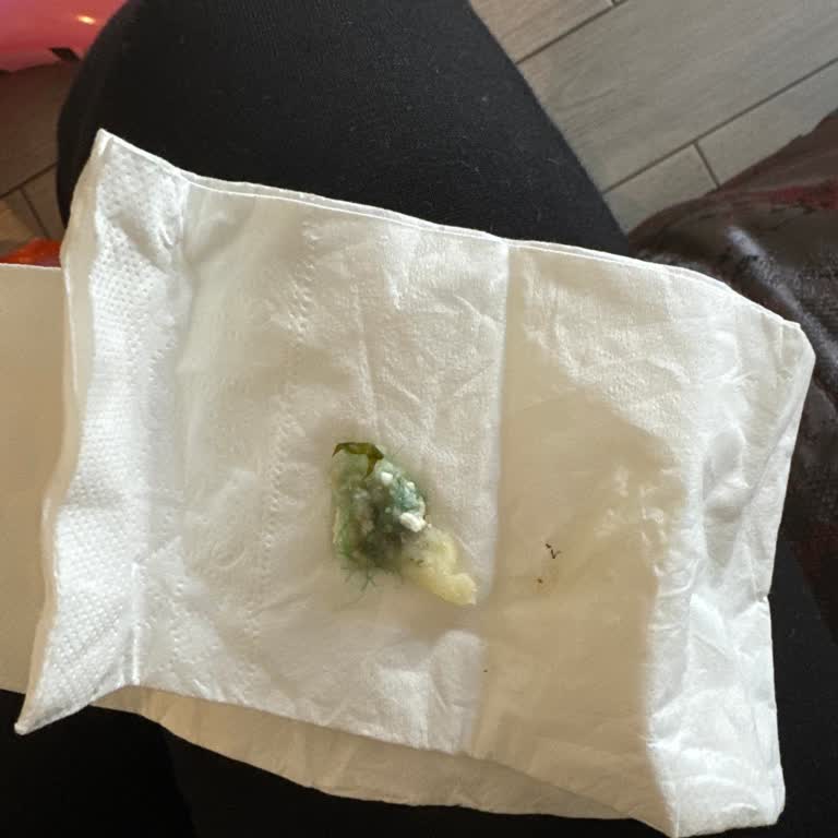 Arbatt Hotels Hijyen Skandalı Tatil Kabusa Dönüştü