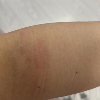 Noya Rental Dress Ürün Kiralama Sorunu