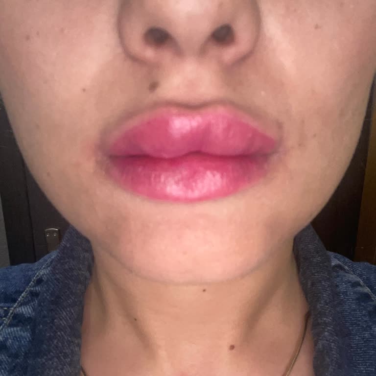 Medica Derma Medica İzmit Şube Mağduriyeti