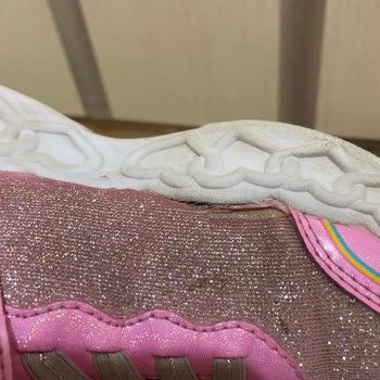 Skechers Mağduriyeti Değişim Yapılmayan Ayakkabı