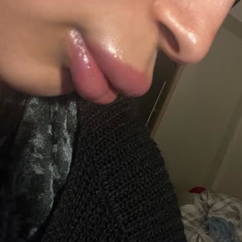 Ars Beauty & Center Hijyen Ve Uyuşturma Eksikliğiyle Kötü Dudak Dolgusu Deneyimi!